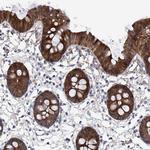 GPT Antibody in Immunohistochemistry (Paraffin) (IHC (P))