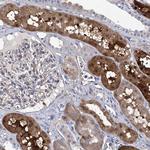 GPT Antibody in Immunohistochemistry (Paraffin) (IHC (P))