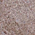 GPT Antibody in Immunohistochemistry (Paraffin) (IHC (P))