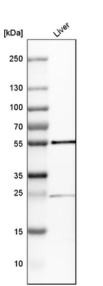 GPT Antibody in Western Blot (WB)