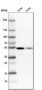 GPT Antibody in Western Blot (WB)