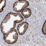 GPBB Antibody in Immunohistochemistry (Paraffin) (IHC (P))
