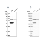 TCP1 Antibody in Western Blot (WB)