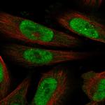 MLLT1 Polyclonal Antibody