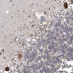 MLLT1 Antibody in Immunohistochemistry (Paraffin) (IHC (P))
