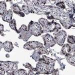 MLLT1 Antibody in Immunohistochemistry (Paraffin) (IHC (P))