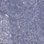 MLLT1 Antibody in Immunohistochemistry (Paraffin) (IHC (P))