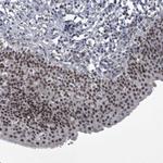 MLLT1 Antibody in Immunohistochemistry (Paraffin) (IHC (P))