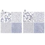 CD41 Antibody in Immunohistochemistry (Paraffin) (IHC (P))