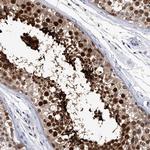 CRISP2 Antibody in Immunohistochemistry (Paraffin) (IHC (P))