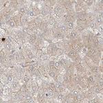 PGD Antibody in Immunohistochemistry (Paraffin) (IHC (P))
