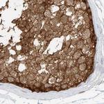 PGD Antibody in Immunohistochemistry (Paraffin) (IHC (P))