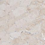 PGD Antibody in Immunohistochemistry (Paraffin) (IHC (P))