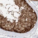 PGD Antibody in Immunohistochemistry (Paraffin) (IHC (P))