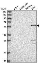 PGD Antibody in Western Blot (WB)
