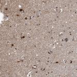 DUSP22 Antibody in Immunohistochemistry (Paraffin) (IHC (P))