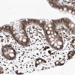 DUSP22 Antibody in Immunohistochemistry (Paraffin) (IHC (P))