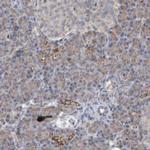 DUSP22 Antibody in Immunohistochemistry (Paraffin) (IHC (P))