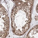DUSP22 Antibody in Immunohistochemistry (Paraffin) (IHC (P))