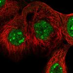 EXOC4 Polyclonal Antibody