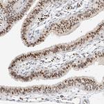 CBX8 Antibody in Immunohistochemistry (Paraffin) (IHC (P))