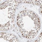 CBX8 Antibody in Immunohistochemistry (Paraffin) (IHC (P))