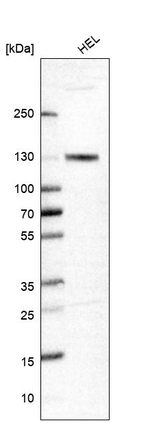 MCM2 Antibody in Western Blot (WB)