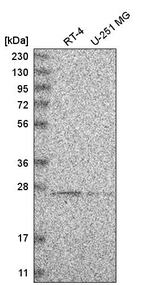 HSCB Antibody in Western Blot (WB)