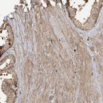 CAPZB Antibody in Immunohistochemistry (Paraffin) (IHC (P))