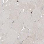 CAPZB Antibody in Immunohistochemistry (Paraffin) (IHC (P))