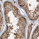 CAPZB Antibody in Immunohistochemistry (Paraffin) (IHC (P))