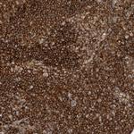 CAPZB Antibody in Immunohistochemistry (Paraffin) (IHC (P))