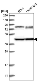 DCDC2 Antibody in Western Blot (WB)
