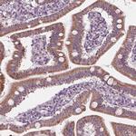 PECI Antibody in Immunohistochemistry (Paraffin) (IHC (P))