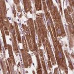 PECI Antibody in Immunohistochemistry (Paraffin) (IHC (P))