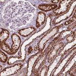 PECI Antibody in Immunohistochemistry (Paraffin) (IHC (P))