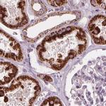 PECI Antibody in Immunohistochemistry (Paraffin) (IHC (P))