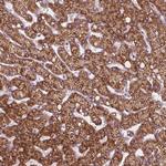 PECI Antibody in Immunohistochemistry (Paraffin) (IHC (P))