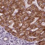 PECI Antibody in Immunohistochemistry (Paraffin) (IHC (P))