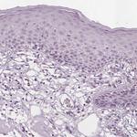 PECI Antibody in Immunohistochemistry (Paraffin) (IHC (P))