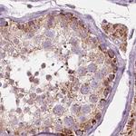 PECI Antibody in Immunohistochemistry (Paraffin) (IHC (P))