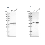 PECI Antibody in Western Blot (WB)