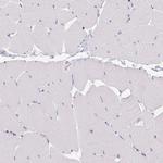 PMEL Polyclonal Antibody