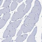 MYLK Polyclonal Antibody