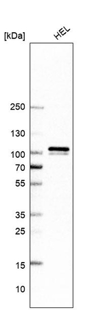 MYLK Antibody in Western Blot (WB)