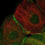 TRIM38 Polyclonal Antibody