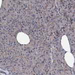 TRIM38 Antibody in Immunohistochemistry (Paraffin) (IHC (P))