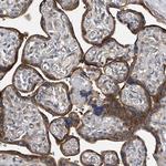 TRIM38 Antibody in Immunohistochemistry (Paraffin) (IHC (P))