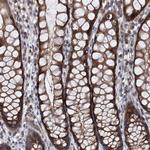 TRIM38 Antibody in Immunohistochemistry (Paraffin) (IHC (P))