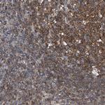 TRIM38 Antibody in Immunohistochemistry (Paraffin) (IHC (P))